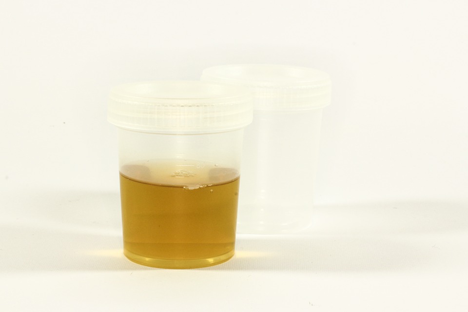 test sample